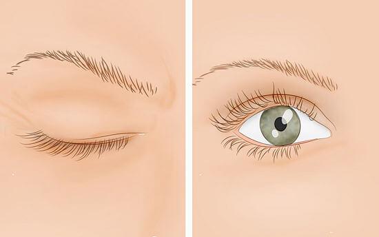 Blinking of Eyes
