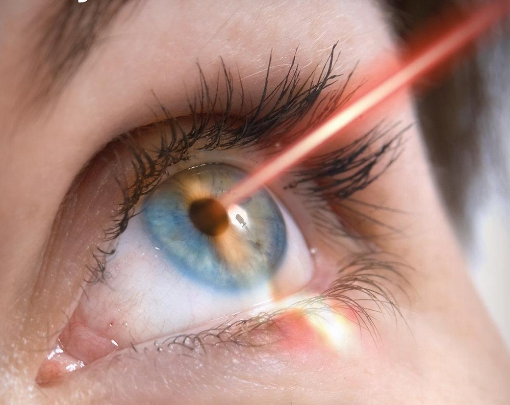 Laser Effect on Eyes