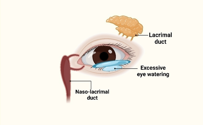 Watering of Eyes